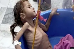 UNİCEF münaqişə zonalarında doğulan uşaqlarla bağlı hesabat hazırlayıb
