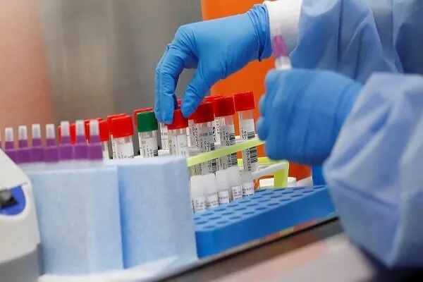 Dünya genelinde Kovid-19 bulaşan kişi sayısı 3 milyon 567 bini aştı