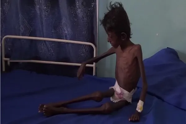 سازمان ملل: چهار میلیون یمنی از زمان آغاز جنگ آواره شده‌اند