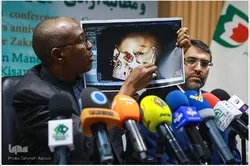 Sheikh Zakzaky apewe matibabu, kubakia kwake hai ni muujiza