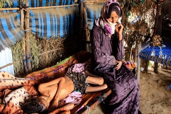‘Yemen vive mayor catástrofe mundial por culpa de Estados Unidos’