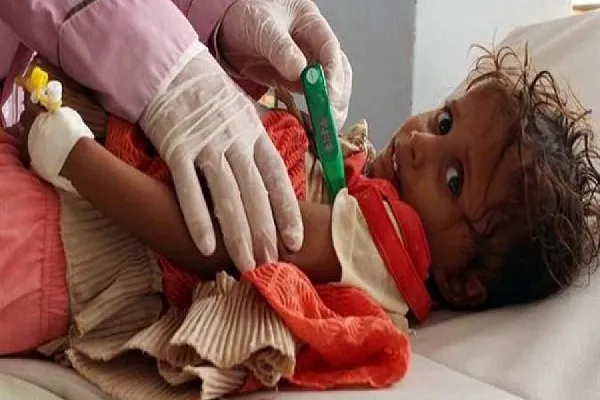 Yemen'de kolera salgının kaynağı keşfedildi