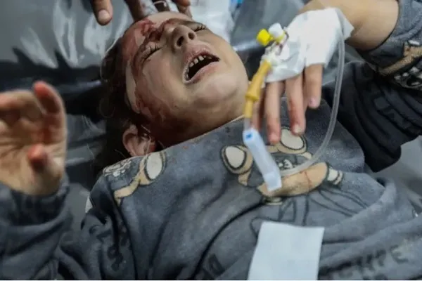 Surat doktor Amerika kepada Biden tentang keadaan menyedihkan di Gaza