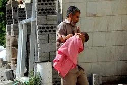Over 100,000 Civilians Killed in Saudi-Led Aggression on Yemen: Report