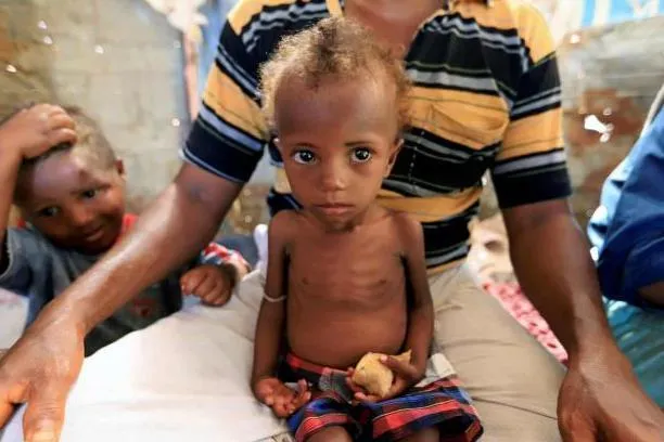 Fame, bombe e morte: nessuna pietà per i bimbi dello Yemen