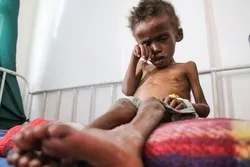 UN Warns of Alarming Rise of Hunger in Yemen