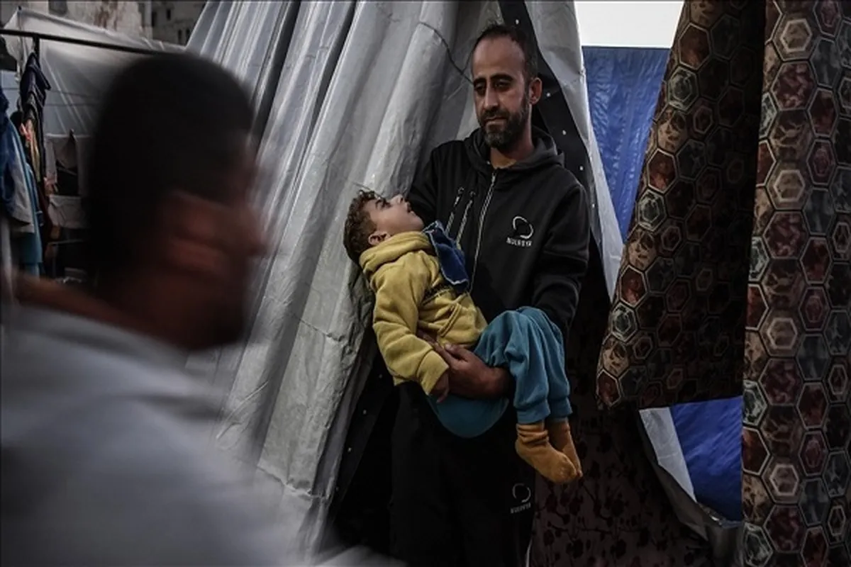 Gaza Child Dies of Severe Malnutrition Caused by Israeli Siege