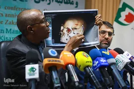 نشست خبری دختر«شیخ زکزاکی»