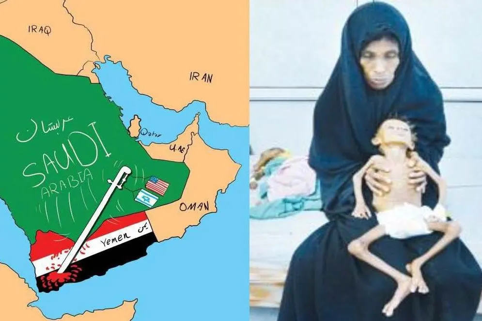 إيران توجّه رسالة إلى الأمم المتحدة حول المجاعة في اليمن