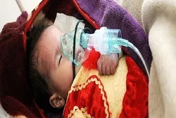 Yəməndə xolera epidemiyası can almağa davam edir