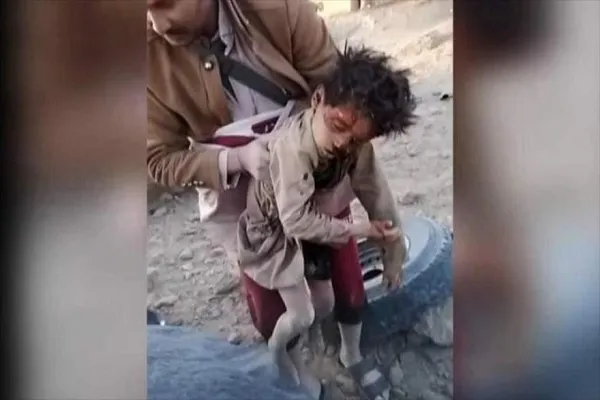Unicef: 19 niños murieron en reciente ataque saudí en Yemen