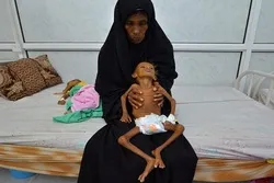 Yemen on Verge of Worst Famine World Has Seen for Decades: UN Chief