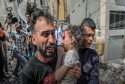 Iran kuwapokea na kuwatibu Wapalestina waliojeruhiwa katika hujuma za utawala wa Kizayuni Ghaza