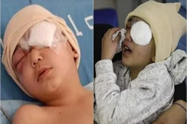 Niño palestino de 5 años pierde un ojo por disparos de fuerzas israelíes