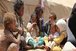 BMT: Yəmənin cənubunda 98.000 uşaq aclığa görə ölümlə üzləşib