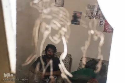 کاظم به دلیل مشکل حاد جسمی توانایی کار کردن ندارد. مادر او دچار بیماری قلبی است. آنها از پس مخارج سنگین درمانی برنمی آیند.