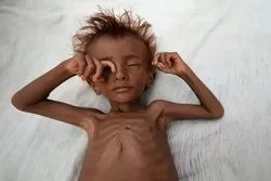 Yemen on Brink of Famine Again: UN