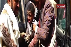 Yəməndə məktəbli uşaqların avtobusu vuruldu
