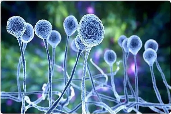 فوت ۴ بیمار ابتلا به قارچ سیاه در گلستان
