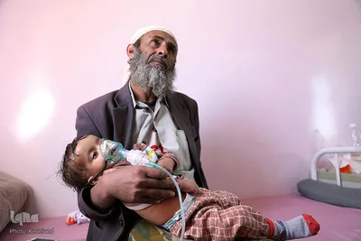 سوءتغذیه کودکان «یمنی» را می کشد