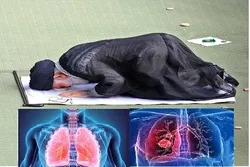 সিজদায় সুস্থ থাকে ফুসফুস