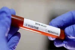 Lutte mondiale contre la xénophobie et union contre le Coronavirus