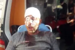 Des Palestiniens blessés et des voitures vandalisées lors d'une attaque de colons près de Naplouse
