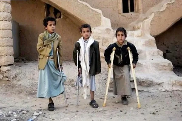 دبیرکل سازمان ملل: ده هزار کودک در جنگ یمن کشته‌ شده‌اند