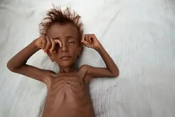 Yemen on Verge of Famine