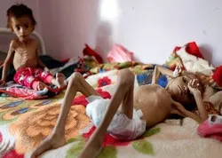 Aide du Japon aux victimes de la famine au Yémen