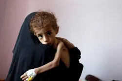 Vita vya Saudia dhidi ya Yemen hupelekea watoto wachanga 100,000 kufariki kila mwaka