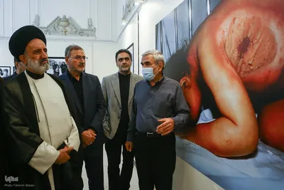 آیین «نَفَس‌های سوخته» در گرامی‌داشت شهدای بمباران شیمیایی سردشت