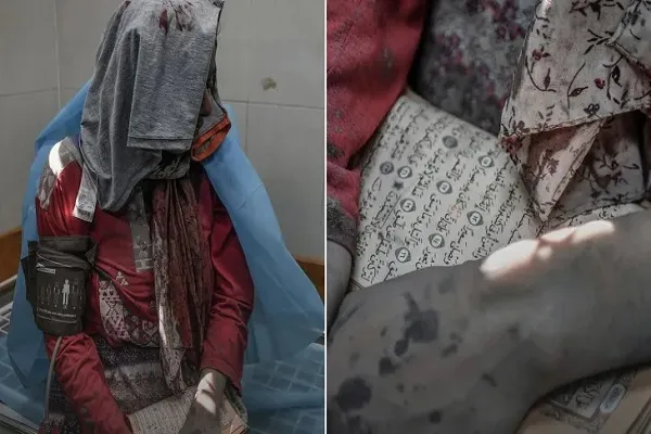 لسان حال غزة: من زاده كتاب الله لن يهزم